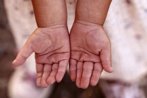 История о том, что ребенку в торговом центре Астрахани отрубило пальцы, оказалась преувеличенной