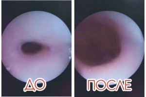 В Астрахани на свет появился ребенок с редким врожденным пороком В Астрахани на свет появился ребенок с редким врожденным пороком