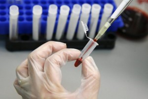 В Астраханскую область приедут мобильные пункты тестирования на ВИЧ