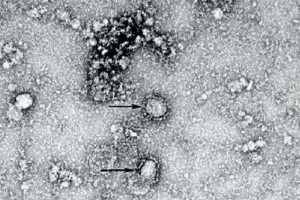 ВОЗ назвала 15 основных симптомов коронавируса