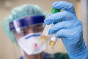 954 новых случаев заражения коронавирусом выявили в России за последние сутки. Два человека скончались