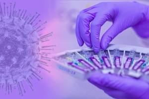 В Москве начнут делать бесплатные тесты на антитела к COVID-19 всем желающим