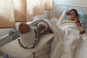 В Астрахани врачи спасли от ампутации стопу подростка, пострадавшего в ДТП