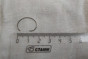 Астраханские медики достали из пищевода 10-месячной малышки металлическое кольцо