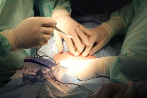 Астраханские хирурги спасли мужчину с&#160;редкой патологией кишечника