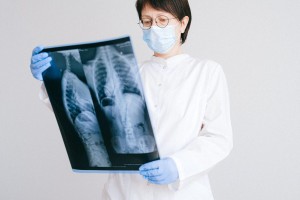 В некоторых астраханских поликлиниках заканчивается пленка для рентгена