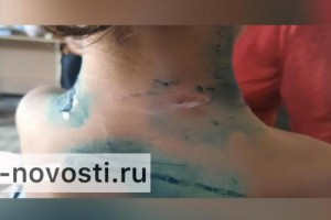 В Астрахани собаки напали на четырехлетнюю девочку