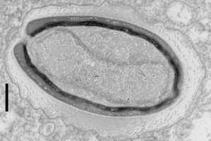 Учёные оживили древние вирусы из сибирской вечной мерзлоты