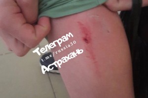 В Астрахани стая собак снова атаковала ребёнка
