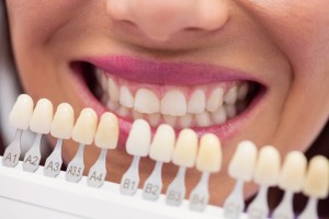Стоматолог рассказала, как нельзя отбеливать зубы