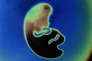 Американские учёные вырастили эмбрион из клеток человека и свиньи