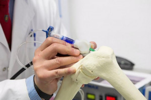 В Астрахани изобрели новый способ изготовления натуральных костных имплантатов