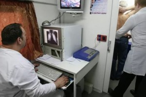 В Астраханской области показатель заболевания туберкулёзом снизился на 8%