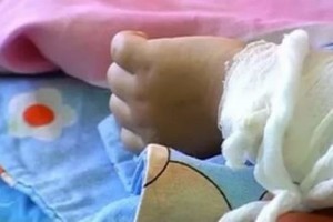В Астрахани 10-месячный ребёнок госпитализирован с термическими ожогами