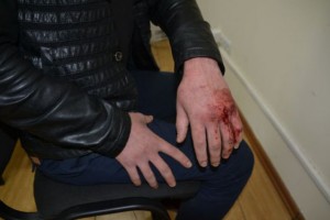 В Астрахани у магазина до смерти забили мужчину