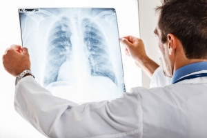 Поликлиника № 10 против туберкулеза: бросьте курить, сделайте флюорографию