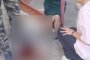 &#171;Оторвала целый кусок кожи&#187;: в&#160;Астрахани собака напала на пожилую женщину