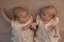 Как получить новые пособия при рождении близнецов